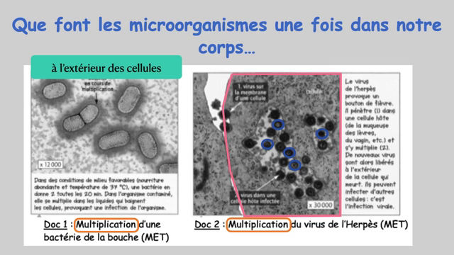 Podeduc Contamination Et Infection Mp