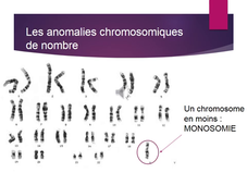 Activité sur la réalisation d'un caryotype