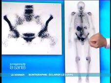 03-La scintigraphie 1.mp4