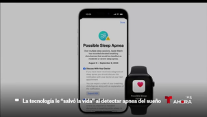 Tecnología que salva vidas (18-07-25, Telemundo).mp4